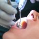 DENTIST IN OTTAWA About Cavities