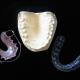 DENTIST IN OTTAWA orthodontic